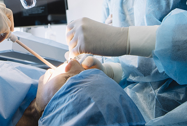 フラップオペレーション、歯周組織再生療法